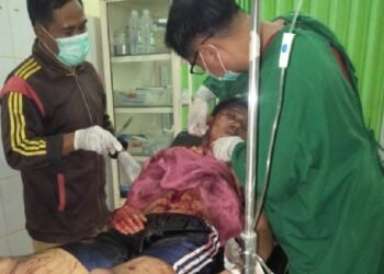 Sadis Bener, Pelaku Curanmor di Serang Todongkan Pistol dan Bacok Korban 1 Sadis Bener, Pelaku Curanmor di Serang Todongkan Pistol dan Bacok Korban