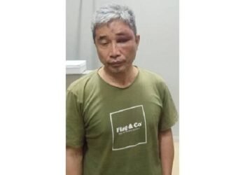 Lumuri Muka Si Tersangka Penistaan Agama Muhammad Kece dengan Tinja, Alasan Napoleon Bonaparte Nonjok Banget