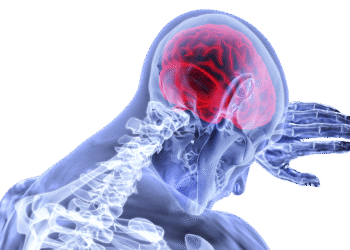 Cara Mengenali Stroke, Gejala dan Tips Mengobatinya