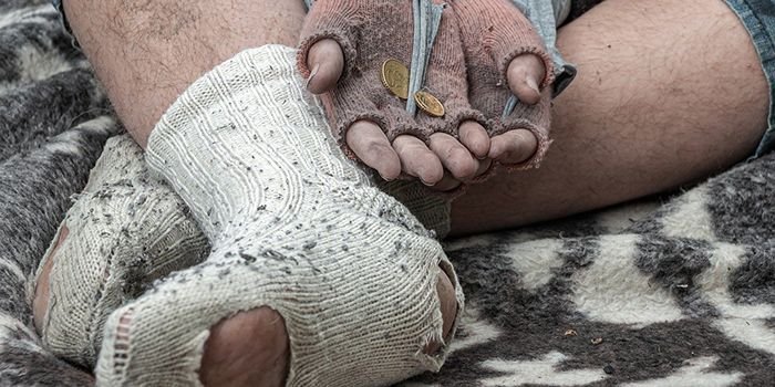 Miris, Penyandang Masalah Kesejahteraan Sosial di Kota Serang Ada 121 Ribu, Tapi Bantuan Hanya untuk 69 Orang 1 Miris, Penyandang Masalah Kesejahteraan Sosial di Kota Serang Ada 121 Ribu, Tapi Bantuan Hanya untuk 69 Orang