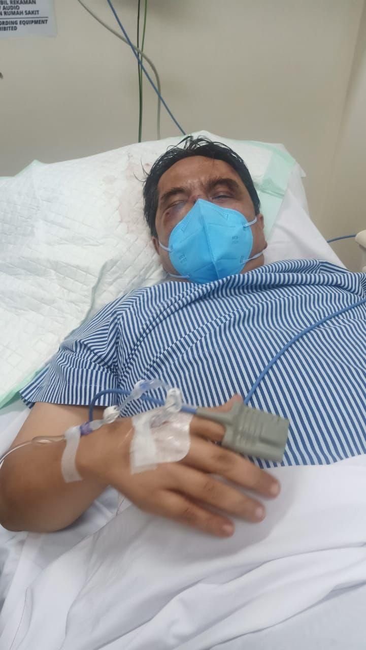 Ade Armando Dipukuli Massa Aksi, Begini Tanggapan dari Beberapa Tokoh Publik