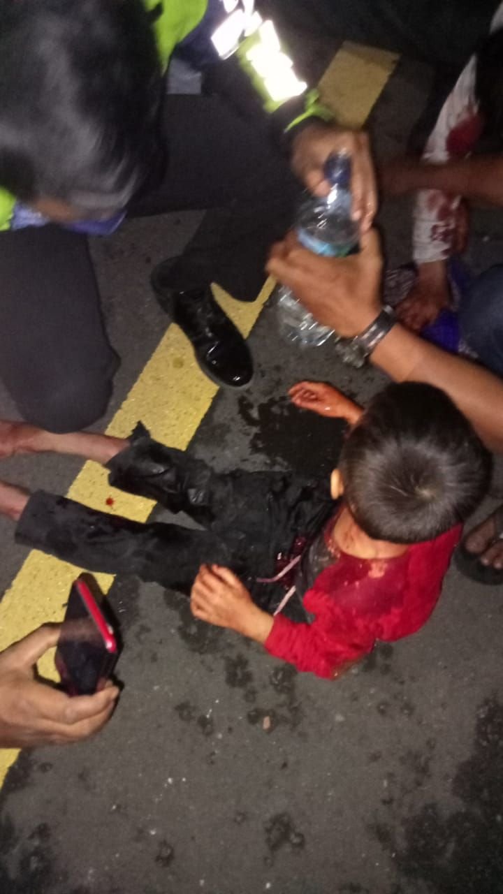 Bus Seruduk 7 Mobil di Tol Tangerang-Merak, Satu Keluarga Luka Berat, Sopir Bus Melarikan Diri 9 Bus Seruduk 7 Mobil di Tol Tangerang-Merak, Satu Keluarga Luka Berat, Sopir Bus Melarikan Diri