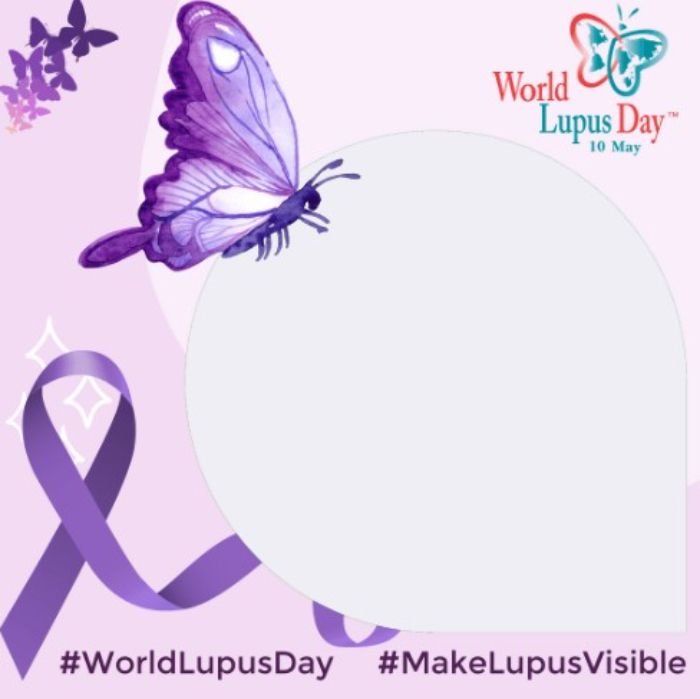 Download Gratis! 15 Link Twibbon Hari Lupus Sedunia 2022 Desain Terbaru, Cocok Dibagikan di Media Sosial