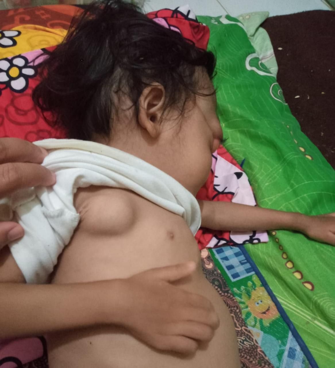 Tolong! Bayi di Bayah Lebak Alami Tumor Otak Butuh Bantuan Para Dermawan 1 Tolong! Bayi di Bayah Lebak Alami Tumor Otak Butuh Bantuan Para Dermawan