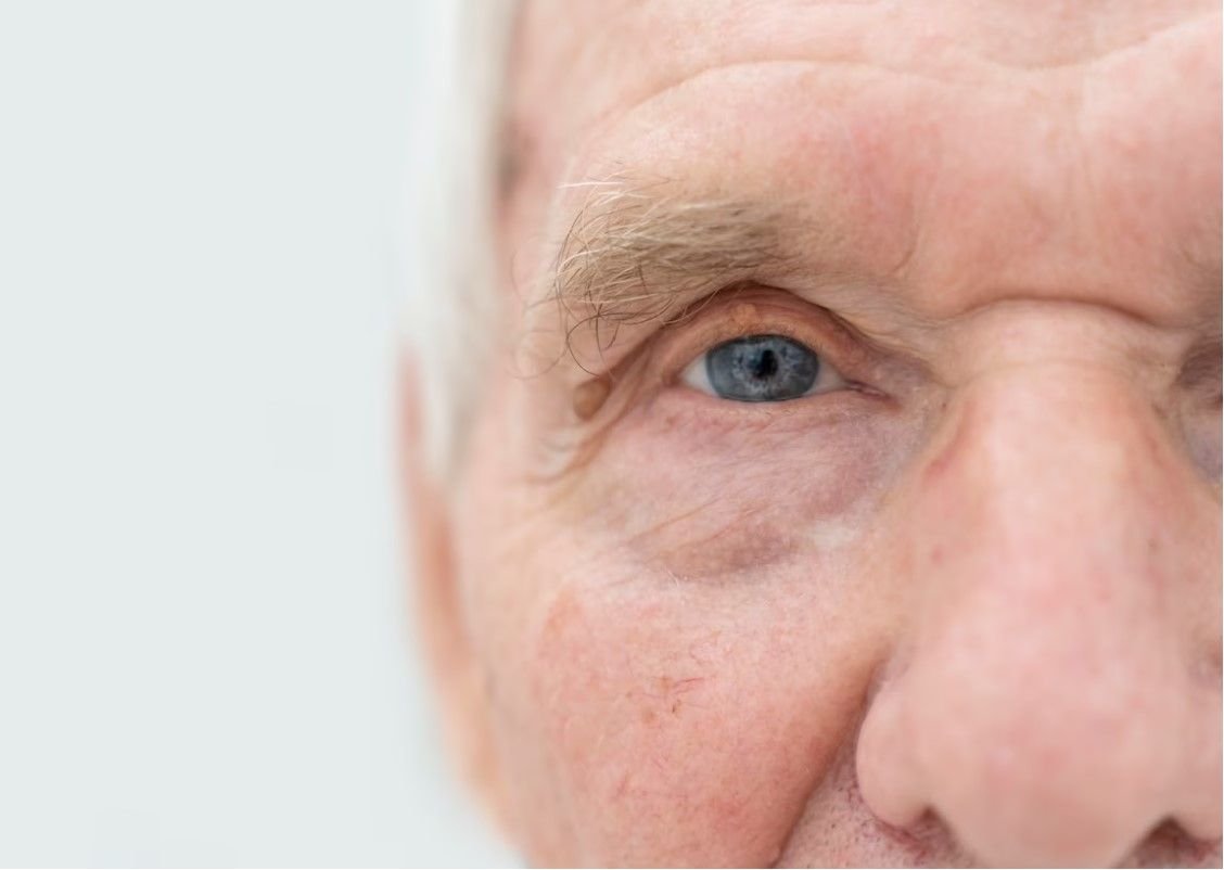 Khawatir Terkena Katarak saat Tua? Coba Ikuti 5 Tips di bawah ini! 3 Khawatir Terkena Katarak saat Tua? Coba Ikuti 5 Tips di bawah ini!