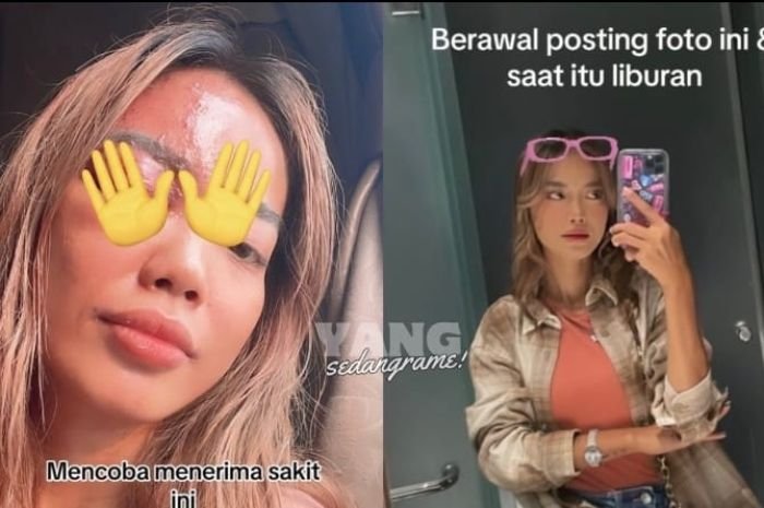 Gegara Dipuji Cantik, Perempuan Ini Curhat Ngaku Langsung Kena Penyakit Ain 2 Gegara Dipuji Cantik, Perempuan Ini Curhat Ngaku Langsung Kena Penyakit Ain