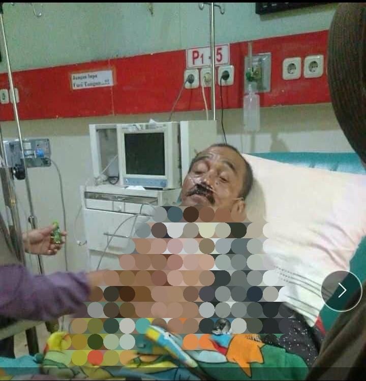 Diduga Kena Begal Saat Narik Penumpang, Kakek Paruh Baya Tukang Ojek di Mekarjaya Pandeglang hingga Terkapar di Jalan