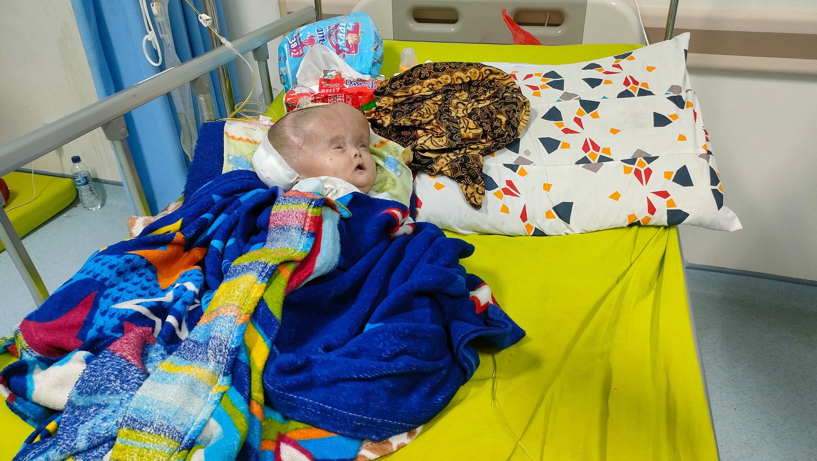 Alami Hidrosefalus, Bayi 4 Bulan di Cikulur Kabupaten Lebak Butuh Bantuan Buat Operasi; 1 Suntikan Rp1 Juta