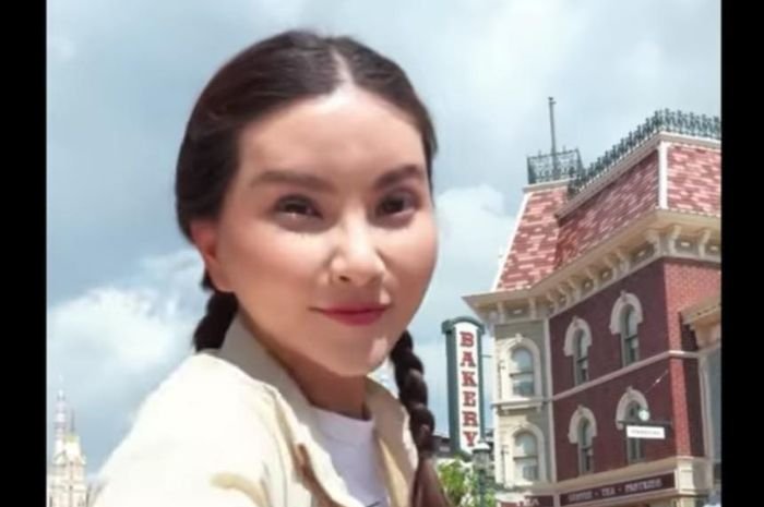 Hasil Operasi Plastik Sarwendah Mendapat Perhatian Warganet, Begini Kata Mereka...