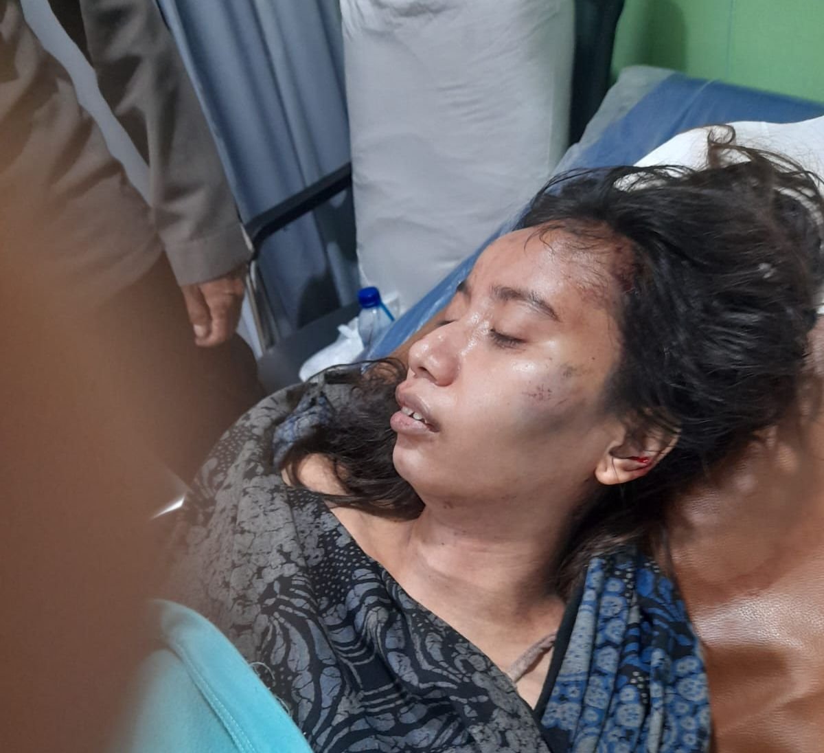 Kepergok Masuk Rumah, Pencuri Hajar Pemilik Rumah Pakai Batu