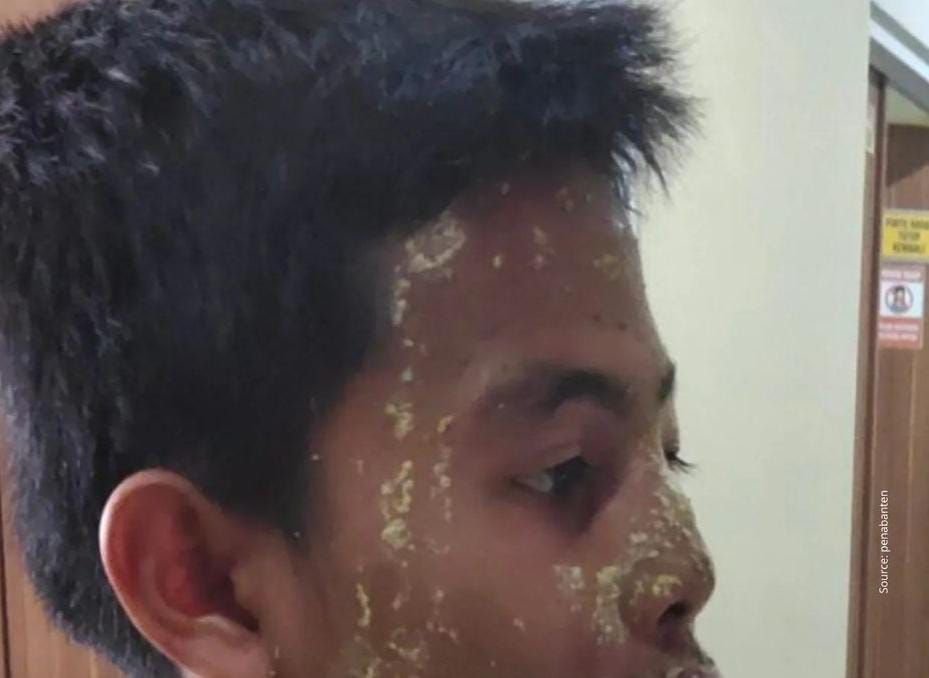 Anak di Ciruas, Serang, Dikeroyok Warga karena Dituduh Mencuri Vape 6 Anak di Ciruas, Serang, Dikeroyok Warga karena Dituduh Mencuri Vape