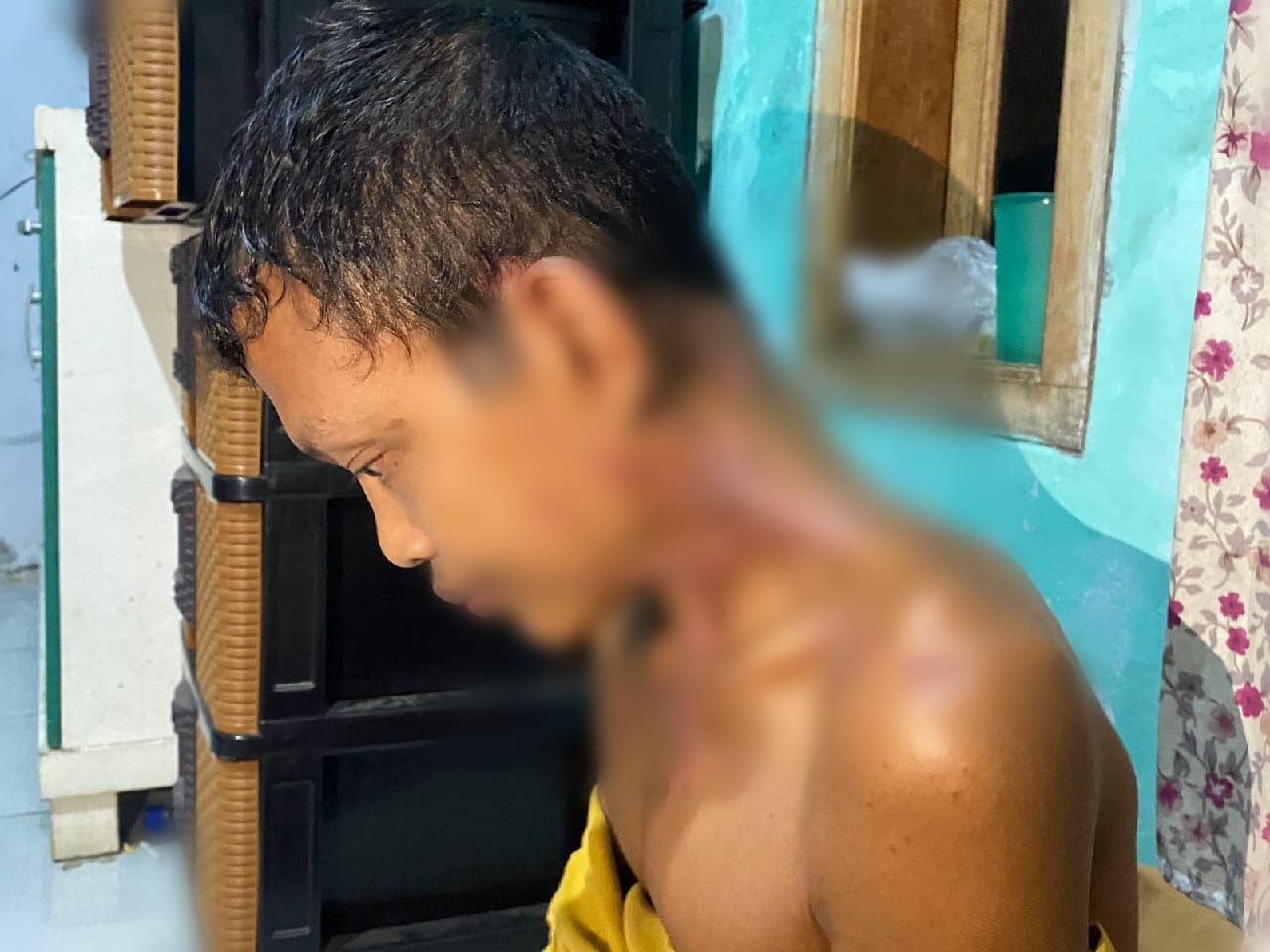 Warga Citangkil Alami Penyakit Misterius, Begini yang Dirasakan