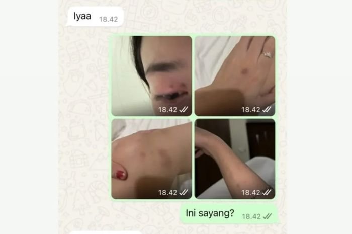 Heboh! Oknum Anggota DPRD Pandeglang Diduga Main Kekerasan hingga Pakai Identitas Mantan Pacar untuk Pinjol