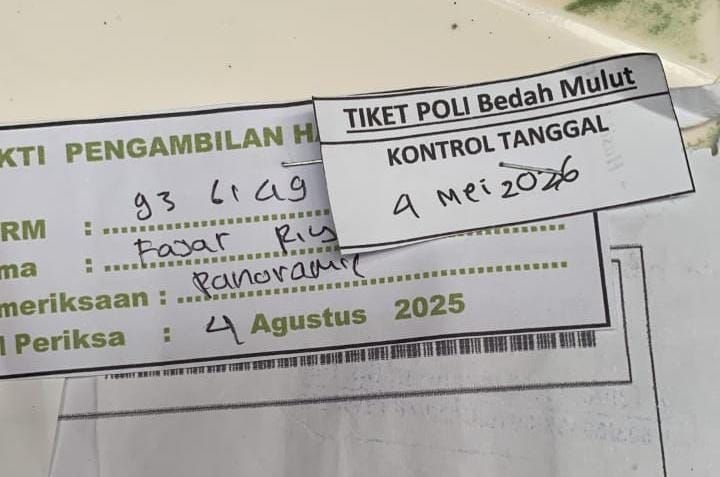 Tolong Pak Robin dan Pak Fajar, Antrean Operasi Bedah Mulut Sampai 10 Bulan di Cilegon